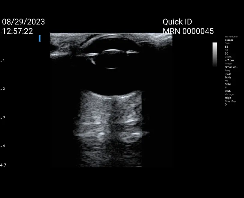 Wi-Fi ultrasound probe for dogs